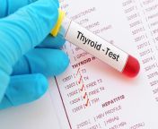 regulat testing for thyroid 11 5b9254255bdd61051df98cac.jpg from tsh
