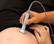 midwife checks baby heart beat movement concept photo childbirth pregnancy postpartum period midwifery pregnet woman 40897495.jpg from pregnet