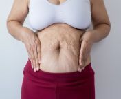 overweight senior women pinching her fat body cellulite squeezing belly around button healthy lifestyle concept woman 157178560.jpg from fat aged navel aunty