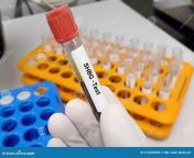 test tube blood sample sex hormone binding globulin shbg diagnosis abnormal testosterone level medical testing 215526893.jpg from test tube sex