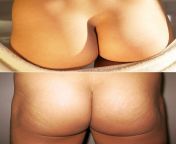 800px human buttocks.jpg from hansika hairy ass hole and pussy