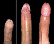 300px ventral and dorsal view of penis.jpg from penis erected