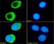 ab281907 2 antitnfrsf14 hvem immunocytochemistry raw2647 cells.jpg from hmhv