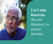 alzheimers association facts and figures inlineimage mortality.jpg from differences between patients who died or survived within 30 days after discharge by q320 jpg