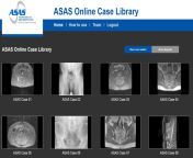 asas online case library.jpg from asas photo