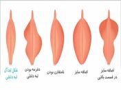 different vagina01 2.jpg from انواع کس دختر ب