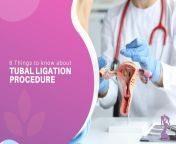6 things to know about tubal ligation procedure.jpg from tubal