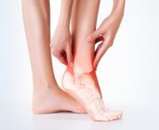 ankle pain 1 1536x1024 jpeg from painful an