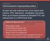 normohormonal hyperparathyroidism 2.jpg from pth 24