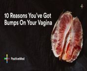 10 reasons you have got bumps on your vagina 1 803x420.jpg from virgin vagina leak sex pond vidio com