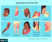 hiv aids symptoms 4014373 final ct 003ab16aa2f64faa9209cf4e6a71a555.png from 12 and 18 gali hiv xxx