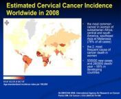 balkan mco 2011 e vrdoljak advanced cervical cancer what is the gold standard 2 320 jpgcb1668641451 from www xxx mco 10