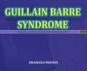 guillain barre syndrome 1 2048.jpg from madhu doctor