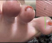 micro tiny eating giantess clean toes and nails by mommabearfeet47 dfvcknv 375w jpgtokeneyj0exaioijkv1qilcjhbgcioijiuzi1nij9 eyjzdwiioij1cm46yxbwojdlmgqxodg5odiynjqznznhnwywzdqxnwvhmgqynmuwiiwiaxnzijoidxjuomfwcdo3ztbkmtg4otgymjy0mzczytvmmgq0mtvlytbkmjzlmcisim9iaii6w1t7imhlawdodci6ijw9odk1iiwicgf0aci6ilwvzlwvn2i0mdmwyjctzdi4ni00mjewltk1owetntgwmmeyyza0ymvmxc9kznzja252lwrlnduzmta2lwyymzktndq2ni1hyznlltawyzgwmdblnthiyi5qcgcilcj3awr0aci6ijw9mte3mcj9xv0simf1zci6wyj1cm46c2vydmljztppbwfnzs5vcgvyyxrpb25zil19 8ti9ugzexq7l pivzqoqadvhegpgh7fuzgxnyyjz2y from giantess micro