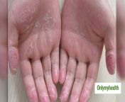 big skin hand.jpg from hand skin goa