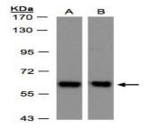 coatomer subunit delta antibody western blot nbp1 32377 img0004.jpg from subanti demta