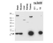 selenoprotein w antibody western blot nbp1 49599 img0008.jpg from 【武汉品茶外卖喝茶 【网址kb40 cn】】49599
