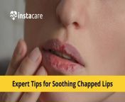  healing dry chapped lips.jpg from thumbs up sweet lip desi anuraga sucking cock mp4