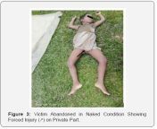 jfsci ms id 555854 g003.png from raped murder deadbody nude sexual voorlichting nude
