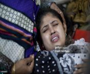 survivor of political victim suffer burns in burn unit of dmch jpgs1024x1024wgik20c 2a1n0t5eaj5i2dtwpmxol0 6gkndkq2hs65rjm9r3m from bangladeshi eden mohila collage student jobaidandian aunty saree videos 3gpld tamil actress ratha sex 3gp