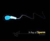 x ray sperm 3d illustration on black background jpgs612x612w0k20c nzitg1paa2aygbw092c5ziijh3wnfxbxi2k3ae5u from x ray cumm
