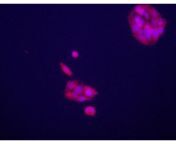 glypican 3 gpc3 antibody c term 2726094 400x300.jpg from dgsx