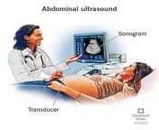 4994 abdominal ultrasound from ultra sound snographi