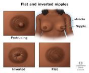 flat inverted nipples.jpg from why are my nipples turning white when i breastfeed jpg