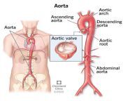 17058 aorta anatomy from wwwaorata