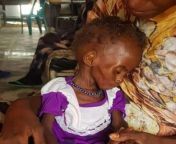 a chid suffering from acute malnutrition in kalma camp on march 7 2024 1 490x485.jpg from sudan