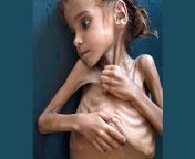 1606381981 5fbf719df079e starvation in war ravaged yemen.jpg from ছোট ছেলে মেয়ের ল্যাংটা খেলা