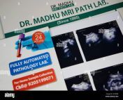 ultrasound scan report 2chf64r.jpg from madhu doctor