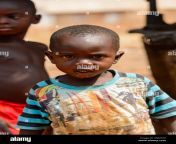 pira benin jan 12 2017 unidentified beninese little boy with dirty face in colored shirt shows his teeth benin children suffer of poverty due to pgm1kp.jpg from benin vano baby azetogbèdé de benin