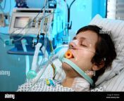 patient lying in a special bed intubated medical appliances for medical treatment and artificial respiration of the patient rd5g5h.jpg from intubated jpg