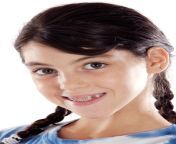 braces for young children.jpg from pigtail braces
