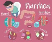 diarrhea 2.jpg from diarrhea on